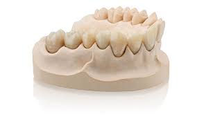 3d printed dental models